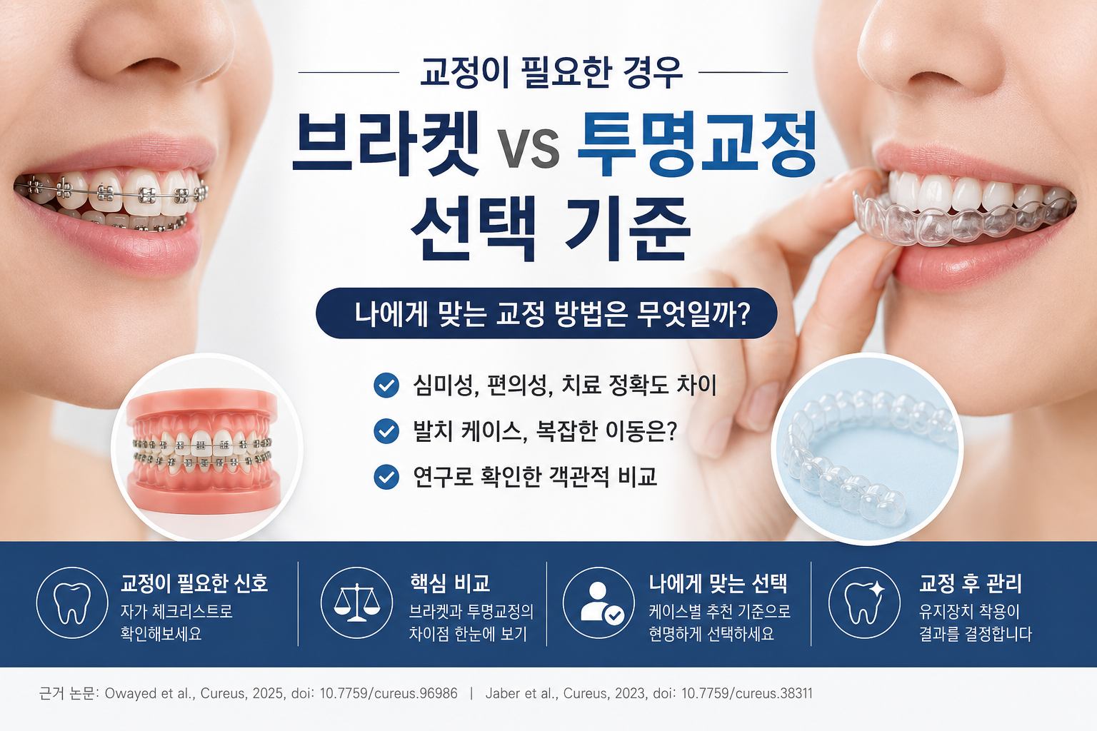 치아교정 종류와 선택 기준 — 브라켓 vs 투명교정, 나에게 맞는 건 뭔가요