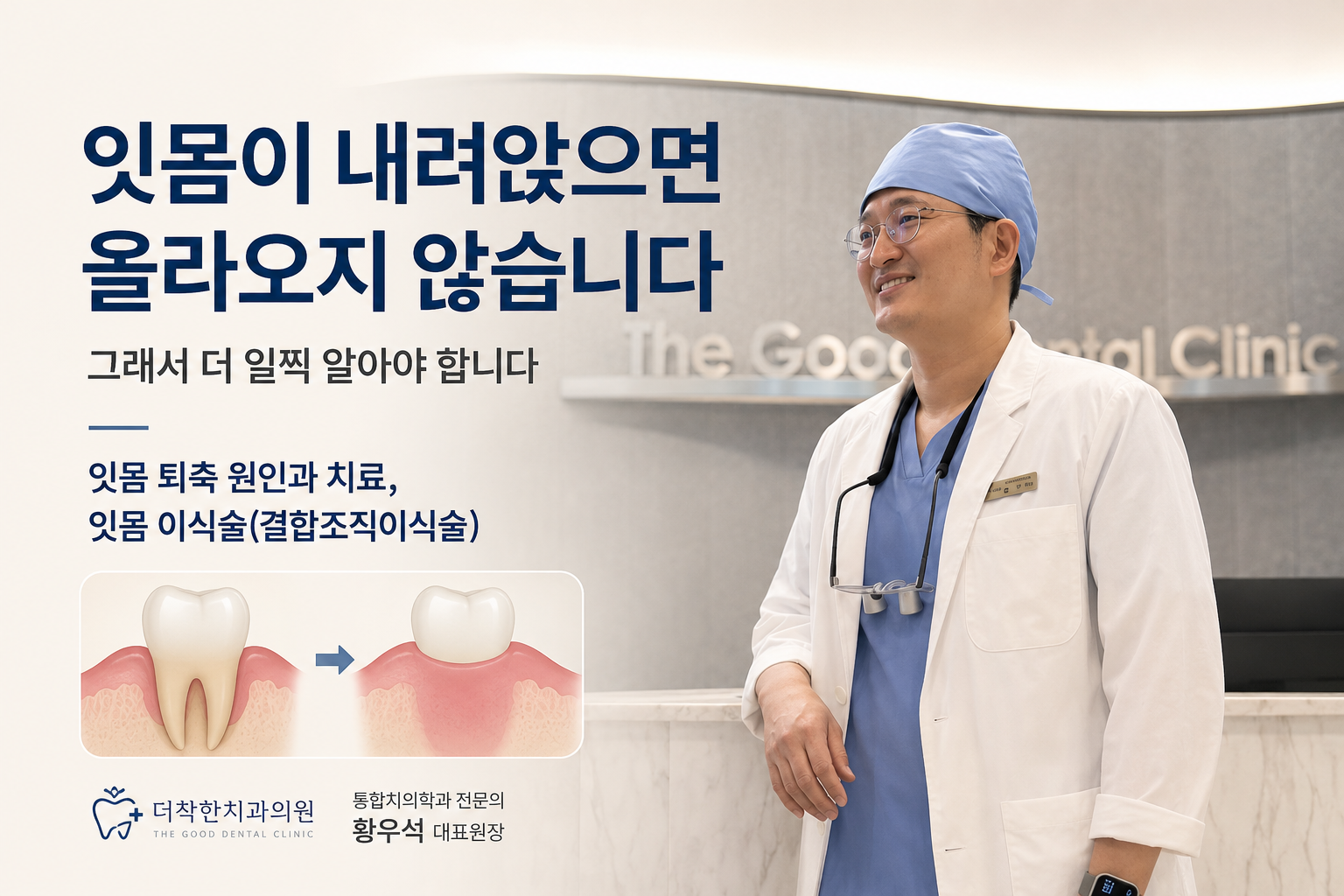 잇몸이 내려앉으면 올라오지 않습니다”라는 핵심 문구를 크게 배치하고, 잇몸 퇴축의 원인과 결합조직 이식술