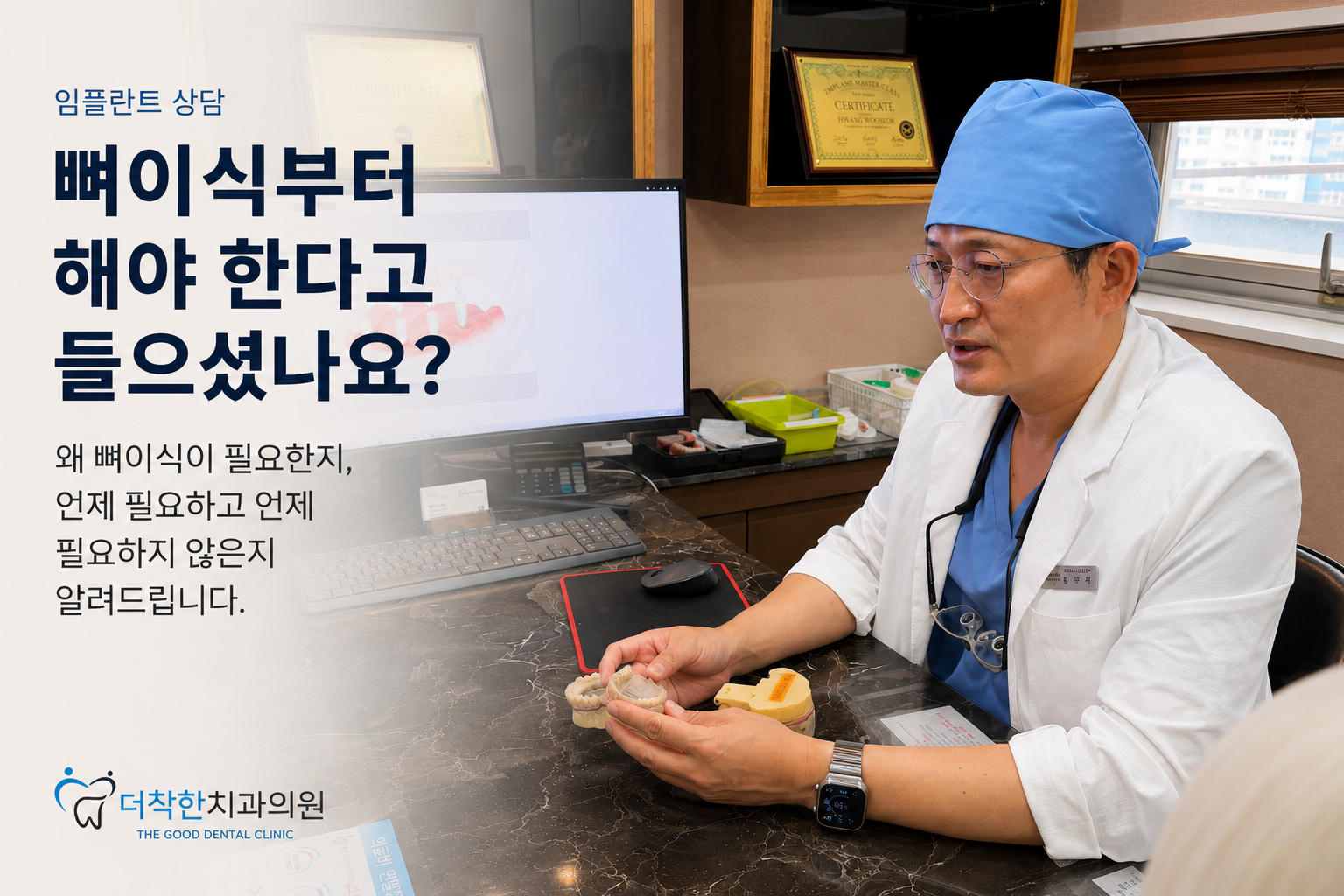 대표이미지 설명(검색 접근성용 대체텍스트) 더착한치과 황우석 원장이 진료실에서 치아 모형을 들고 임플란트 상담을 하는 모습. ‘뼈이식부터 해야 한다고 들으셨나요?’라는 제목과 함께 임플란트 골이식이 필요한 이유와 발치 후 뼈 흡수, 골이식이 필요한 경우와 필요하지 않은 경우를 설명하는 대표이미지.