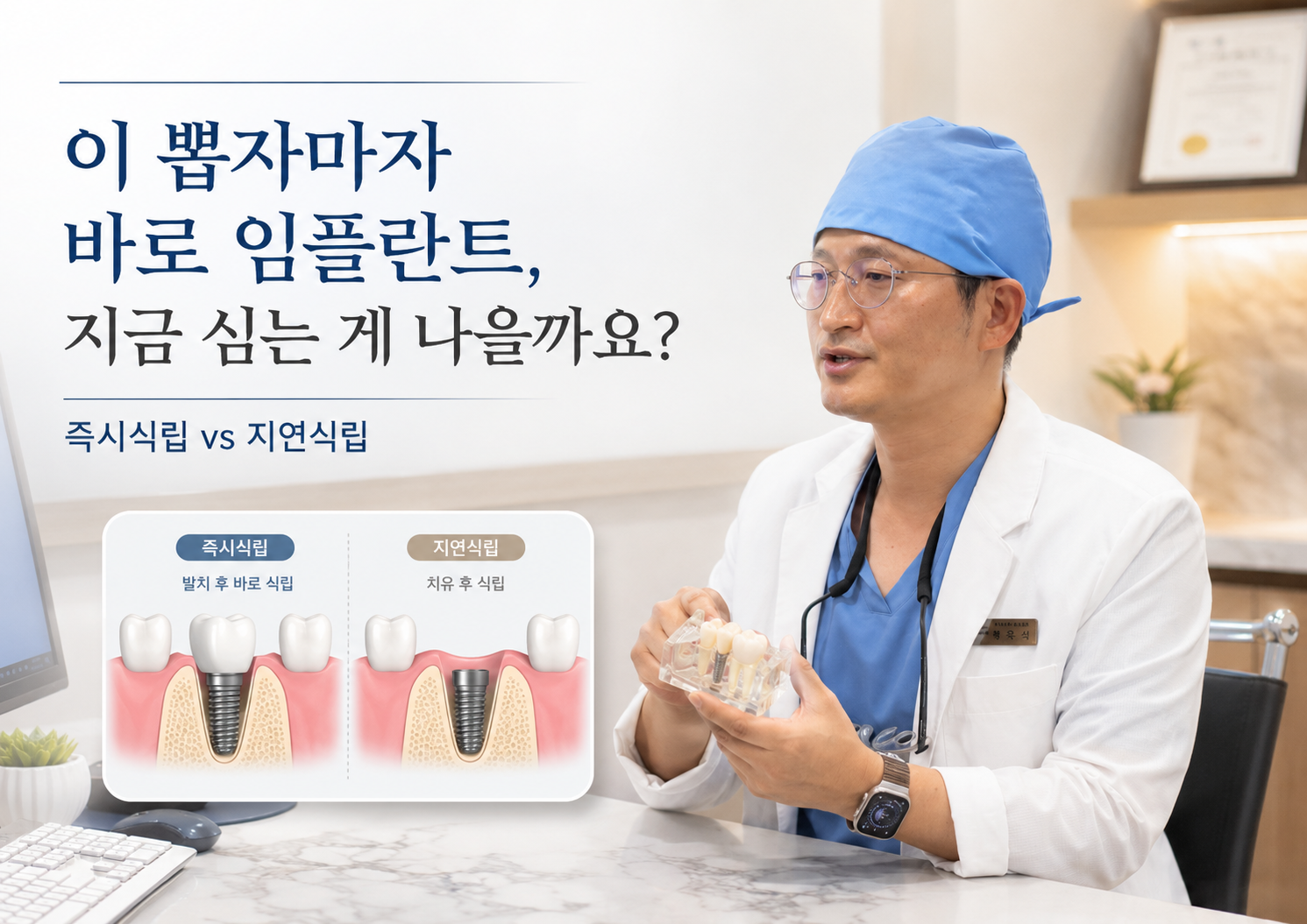 이 뽑자마자 바로 임플란트, 지금 심는 게 나을까요?” 하단 작은 문구는 “즉시식립 vs 지연식립, 무엇이 더 안전할까” 정도가 가장 좋겠습니다.