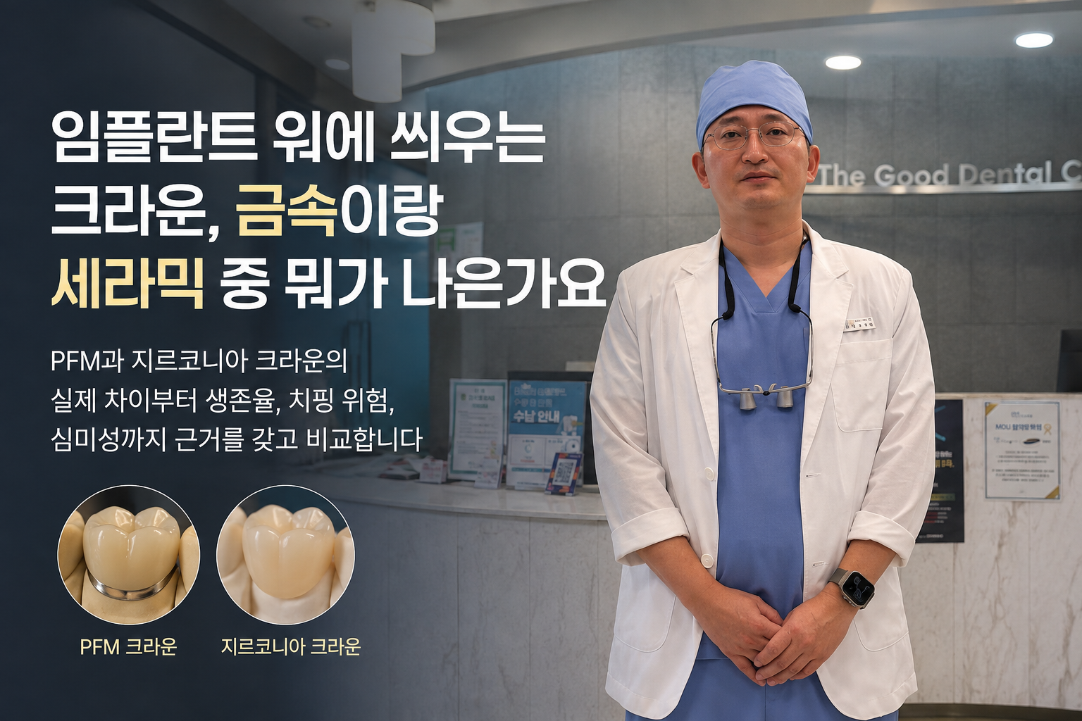 대표이미지 설명(대체텍스트): 더착한치과 황우석 원장이 진료복을 입고 치과 접수대 앞에 서 있는 모습과 함께, 임플란트 크라운 재료인 PFM과 지르코니아를 비교한 이미지. PFM 크라운과 지르코니아 크라운의 심미성, 강도, 치핑 위험, 생존율 차이를 설명하는 칼럼 대표사진.