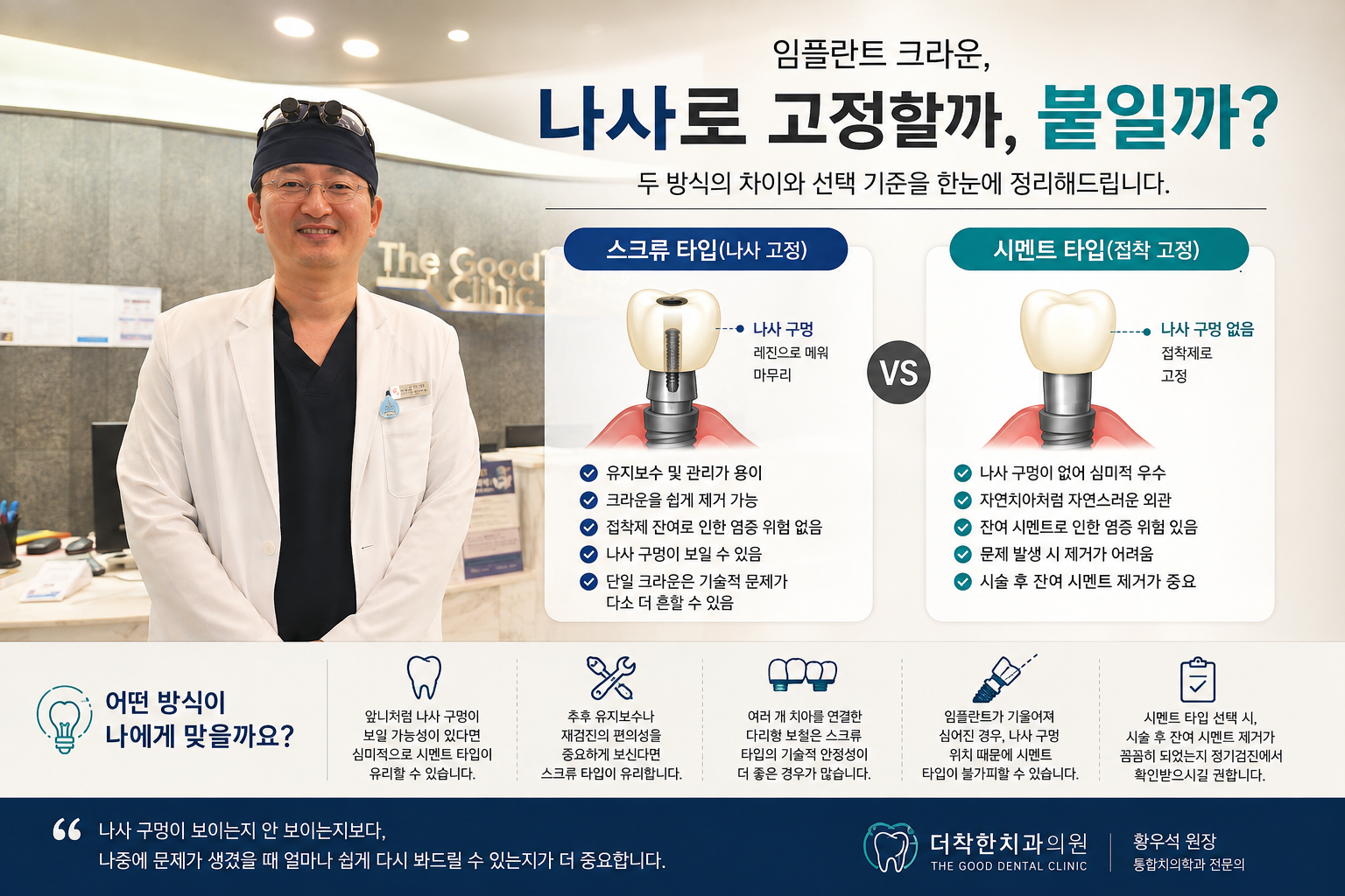 대표이미지 설명(대체 텍스트): 더착한치과 황우석 원장이 치과 내부에 서 있고, 옆에는 임플란트 크라운의 스크류 타입과 시멘트 타입 구조 및 장단점을 비교한 안내 이미지가 배치되어 있다. 스크류 타입은 유지보수가 쉽고 제거가 가능하며, 시멘트 타입은 나사 구멍이 없어 심미적이라는 차이를 보여준다.