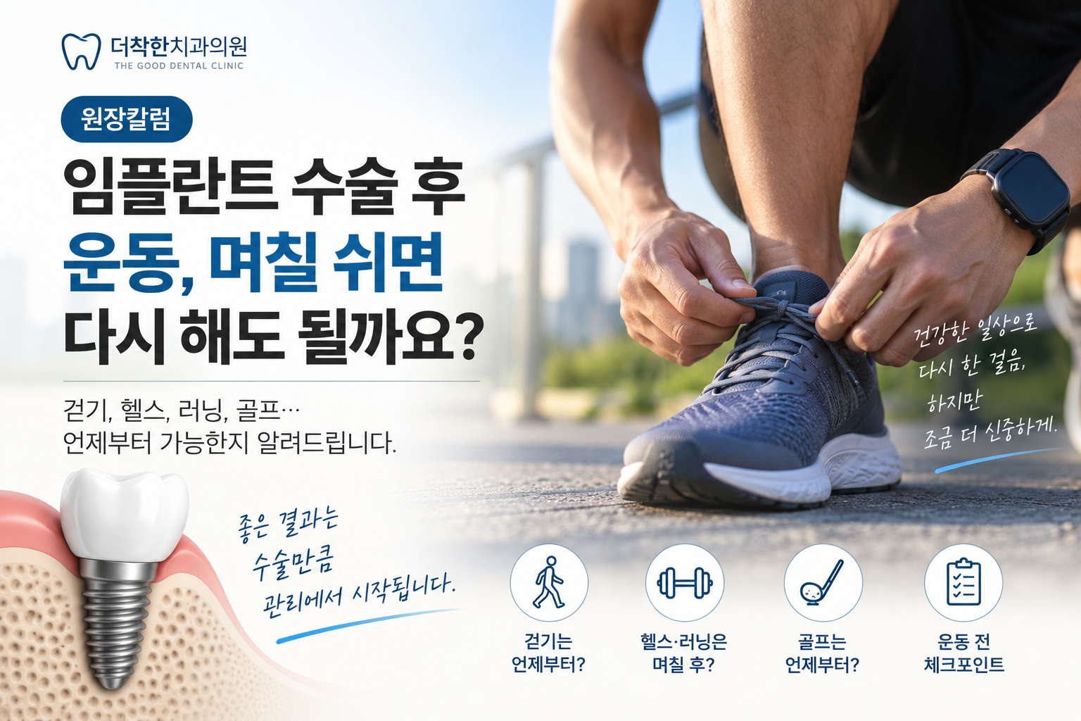 임플란트 수술 후 운동 재개 시점을 안내하는 이미지입니다. 운동화를 신는 모습을 중심으로 걷기·헬스·러닝·골프를 언제부터 다시 시작할 수 있는지 보여주며, 정해진 날짜보다 출혈·붓기와 수술 부위의 회복 상태를 확인하는 것이 중요하다는 내용을 담았습니다.