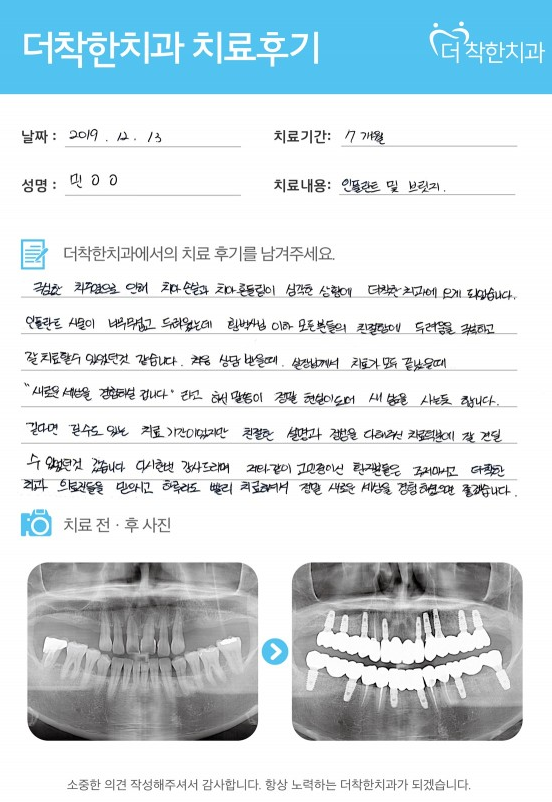 치주질환으로 손상된 치아, 7개월간의 임플란트·보철치료로 건강한 미소를 되찾았습니다.