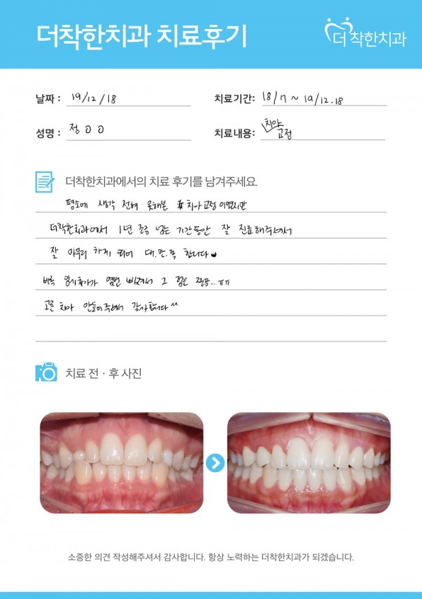 1년간의 치아교정 치료, 달라진 치아 배열과 만족스러운 변화