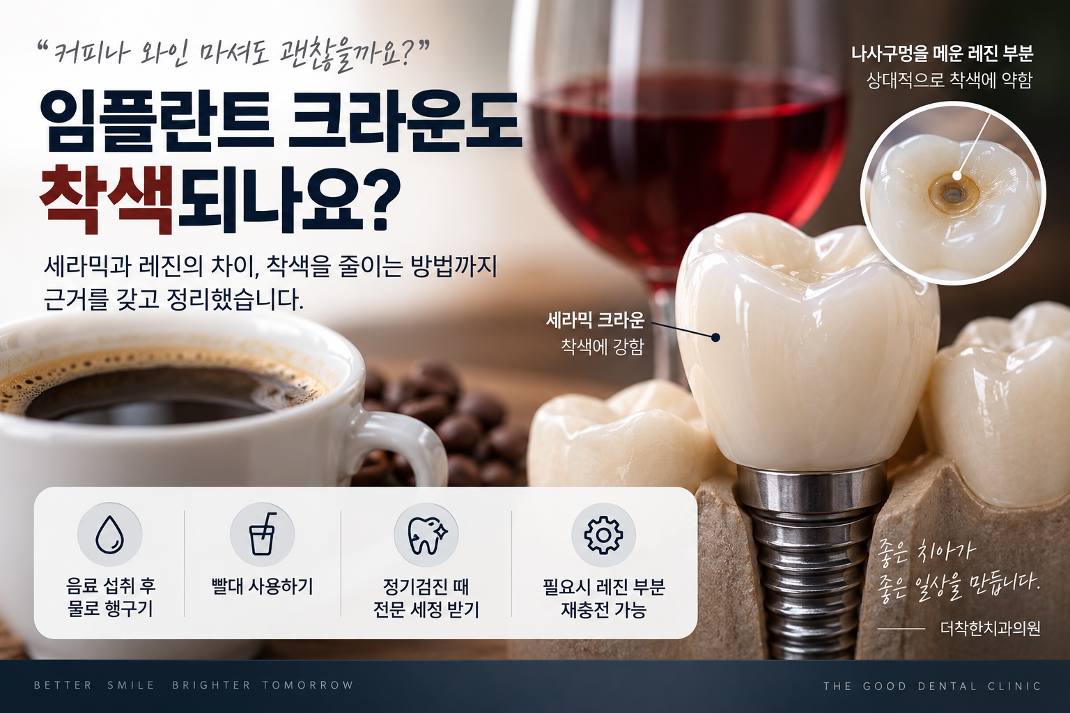 임플란트 크라운과 커피·레드와인을 함께 보여주며, 세라믹 크라운은 착색에 비교적 강하지만 스크류 타입 크라운의 나사구멍을 메운 레진 부분은 상대적으로 착색되기 쉽고, 음료 섭취 후 물로 헹구기와 정기적인 전문 세정으로 착색을 줄일 수 있음을 설명한 이미지