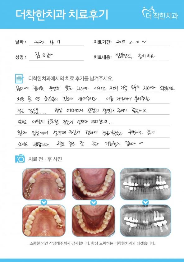임플란트와 충치치료 후 달라진 모습, 환자분의 솔직한 치료 후기