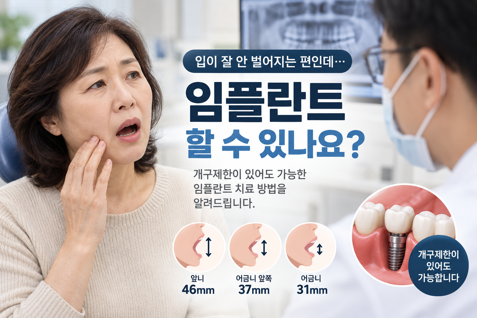 입이 잘 안 벌어지는 편인데, 임플란트할 수 있나요