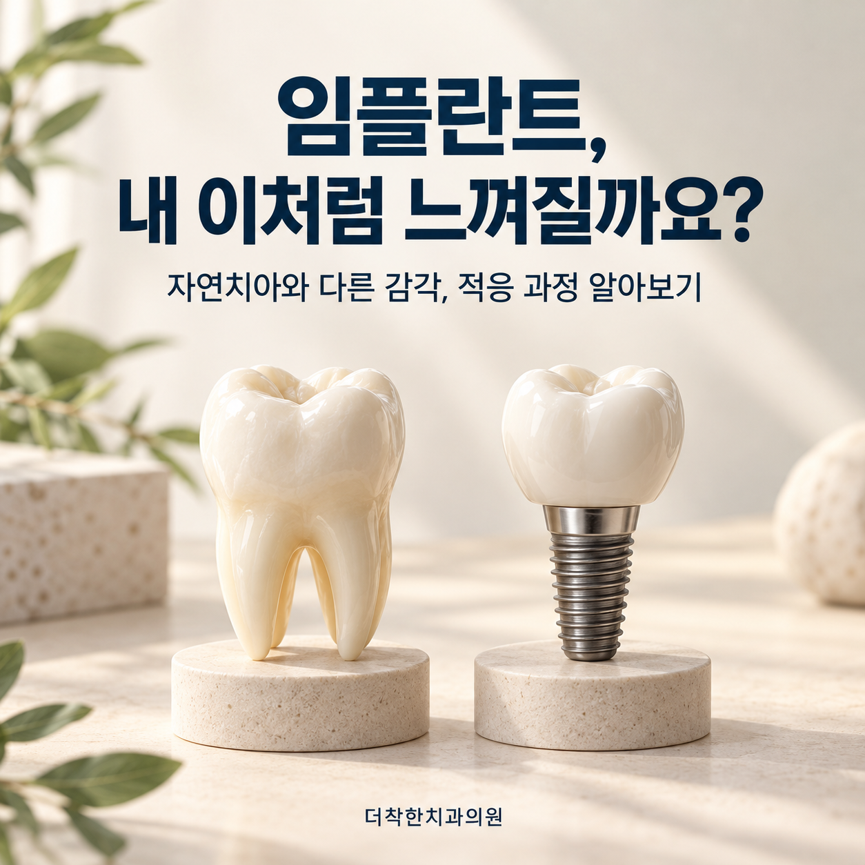자연치아와 임플란트 모형을 나란히 배치해 임플란트의 느낌과 적응 과정을 안내하는 더착한치과의원 대표이미지.