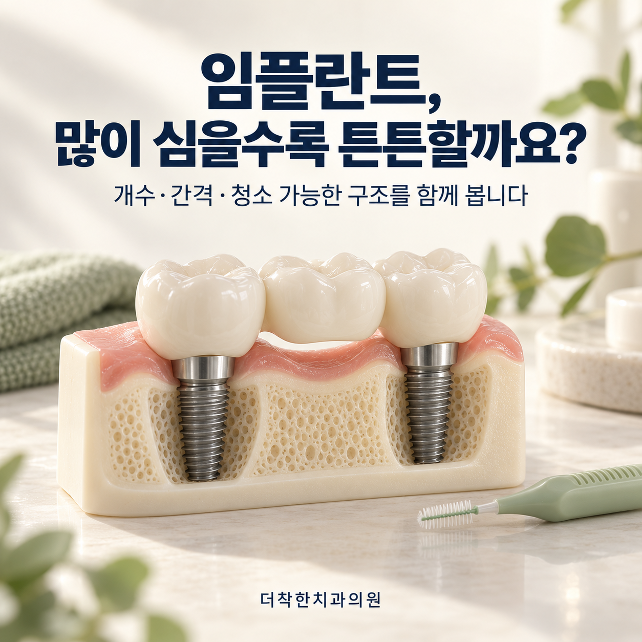 임플란트 개수와 간격, 몇 개를 얼마나 띄워 심어야 하나요?