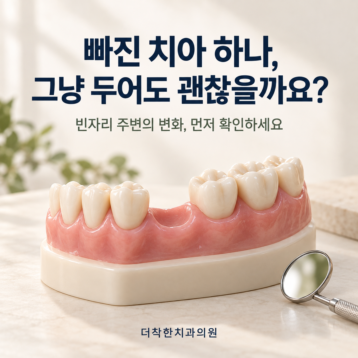 빠진 치아를 그대로 두면 잇몸뼈가 줄고 맞물리던 치아와 옆 치아가 조금씩 움직일 수 있습니다. 모두가 서둘러야 하는 것은 아니니, 현재 상태를 확인하고 치료 시점을 함께 정하세요.