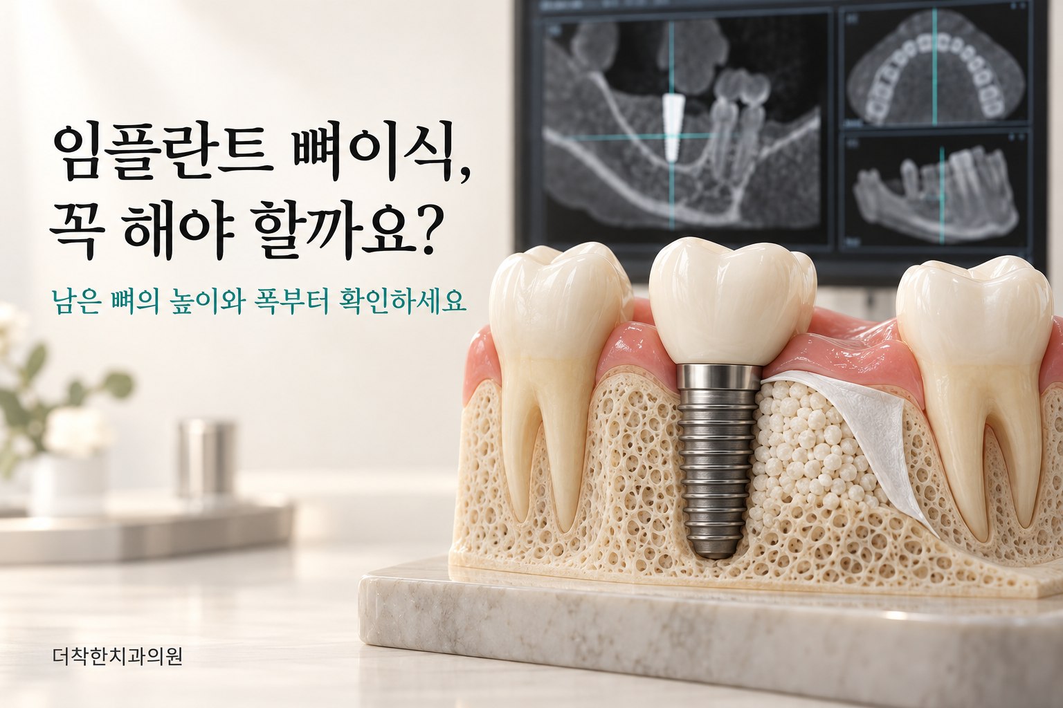 alt: CT 영상과 임플란트 주변의 부족한 뼈를 이식재와 차단막으로 보강하는 단면 모형을 통해, 뼈이식 전 남은 뼈의 높이와 폭을 확인하도록 안내하는 이미지.