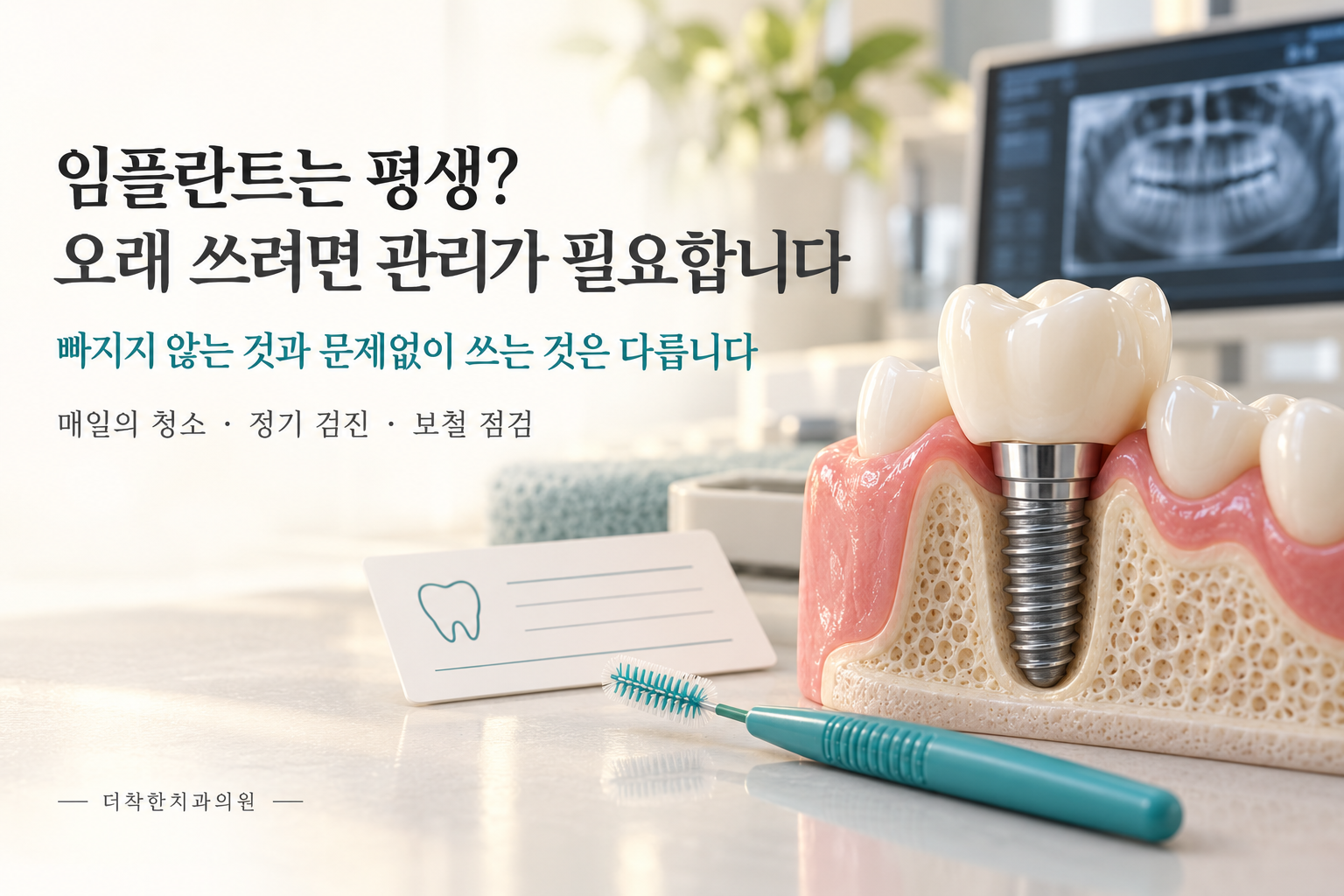 alt: 임플란트 단면 모형과 치간칫솔, 검진 카드를 배치해 매일의 청소와 정기 검진, 보철 점검의 중요성을 안내하는 이미지.