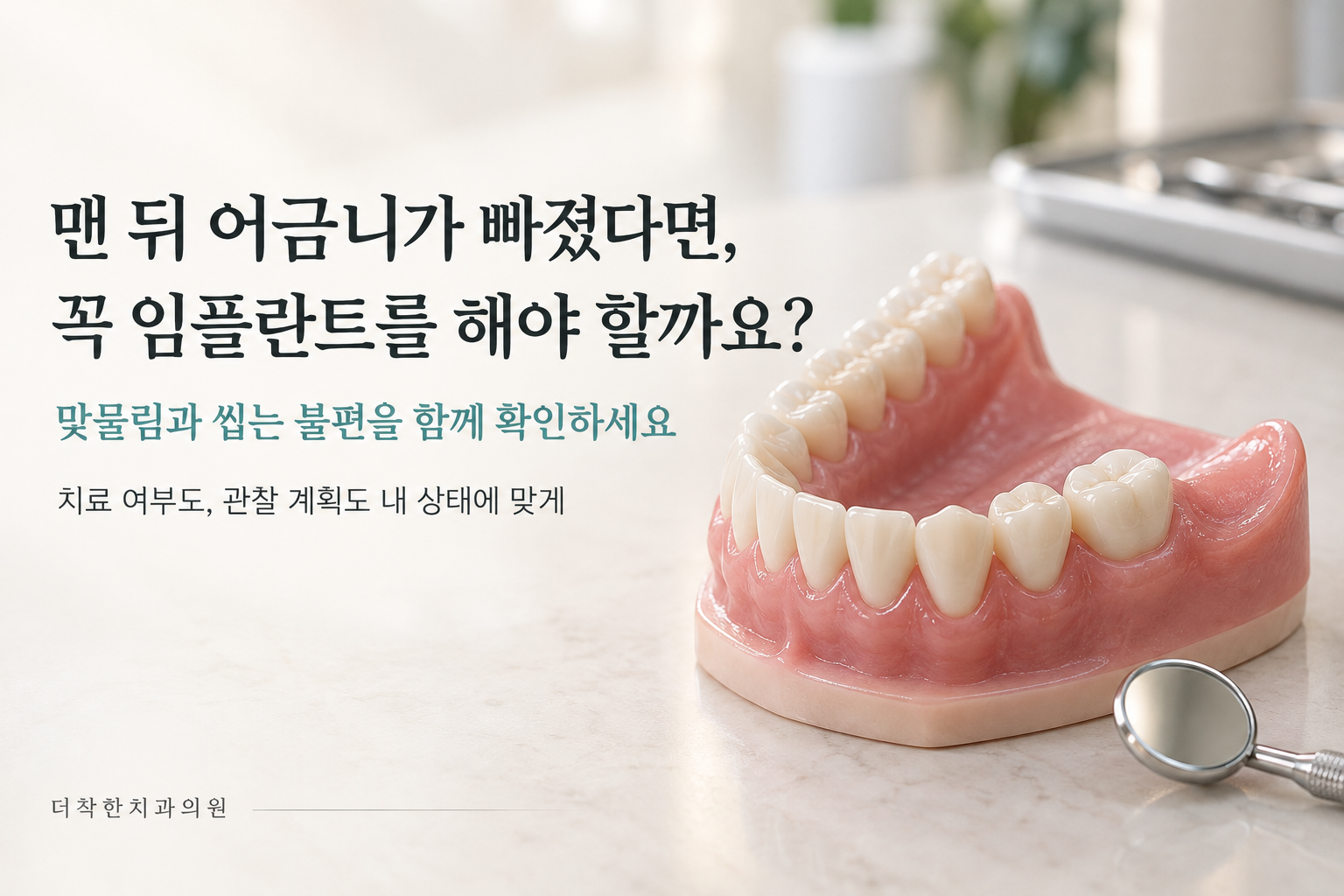 alt: 맨 뒤 어금니가 빠진 치아 모형과 치과용 거울을 배치해, 맞물림과 씹는 불편에 따라 임플란트 치료 여부를 판단하도록 안내하는 이미지.