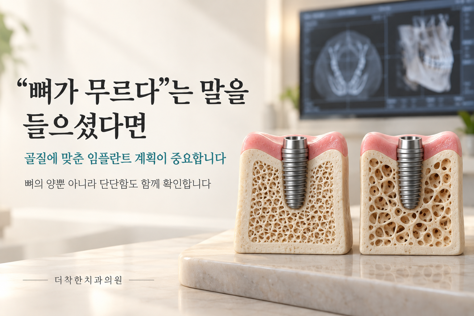 alt: 촘촘한 뼈와 성근 뼈에 심은 임플란트 단면 모형을 나란히 배치해, 골질에 맞춘 치료 계획의 중요성을 안내하는 이미지.